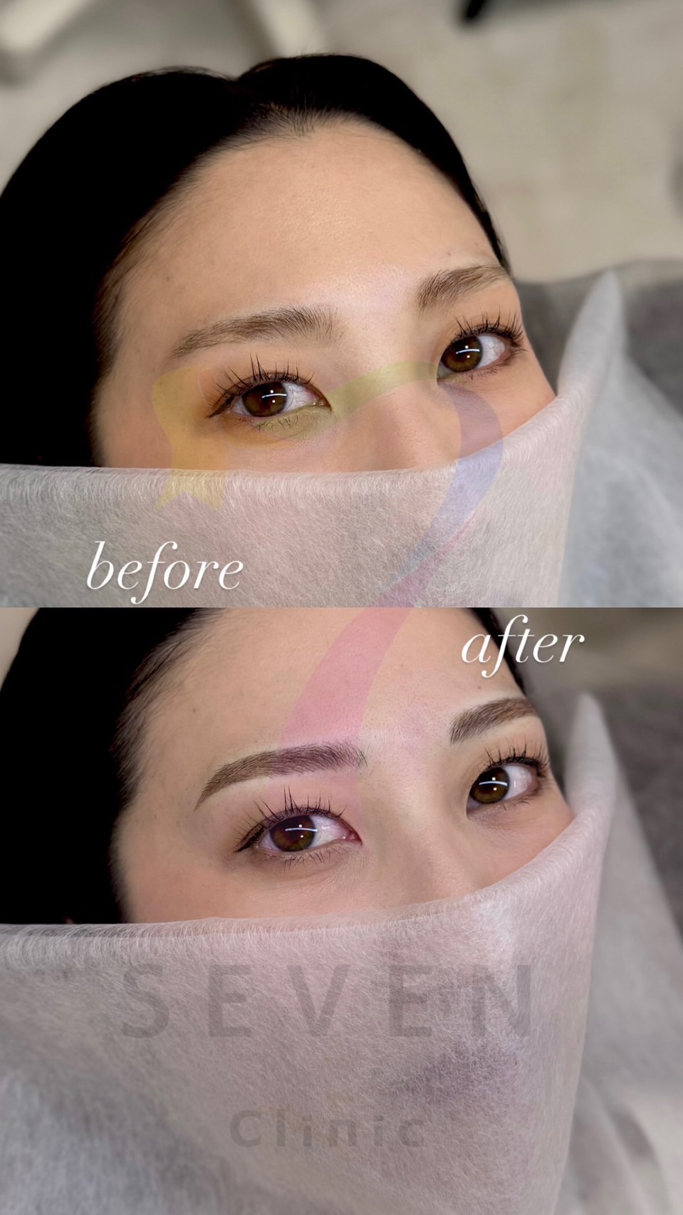 ［テスト05］医療アートメイク